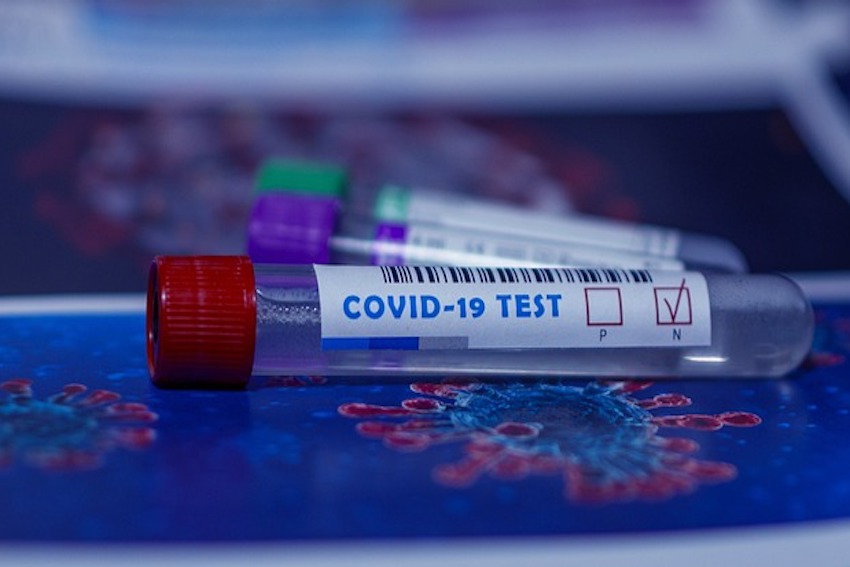 Ein Röhrchen aus Glas. Auf dem Glas steht: Covid-19 Test. Im. Glas gibt es eine Flüssigkeit. Damit wird getestet, ob jemand mit dem Corona-Virus angesteckt ist. Dieser Test ist negativ. Das heisst: Die getestete Person hat das Corona-Virus nicht.